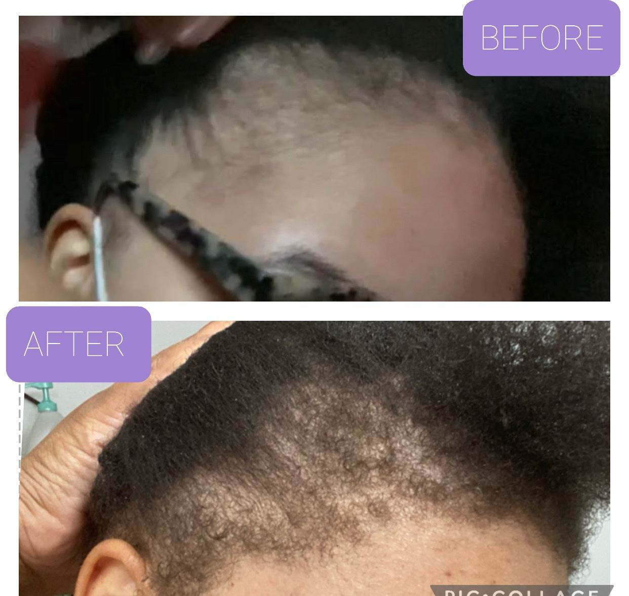 Hair Growth Oil